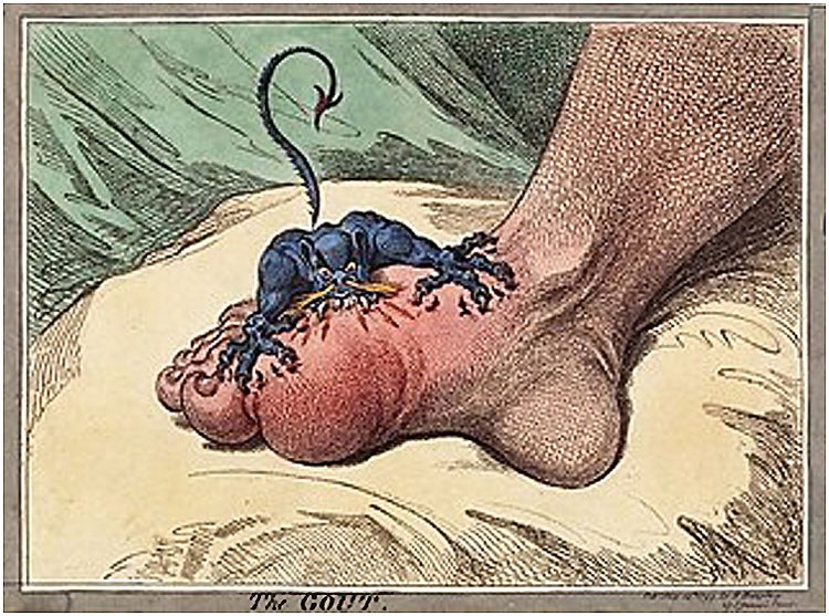 The Gout James Gillray 1799